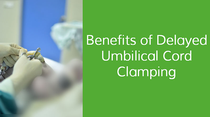 Benefits of Delayed Umbilical Cord Clamping | Vegalicious